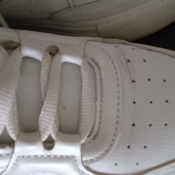 Kısa Sürede Deforme Olan Ve Rahatsızlık Veren Ayakkabı İçin Yardım Talebi