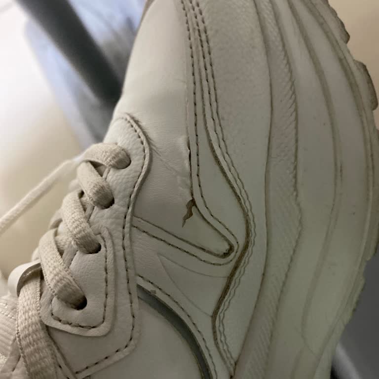 Kısa Sürede Deforme Olan Yüksek Fiyatlı Ayakkabı Hayal Kırıklığı Yarattı