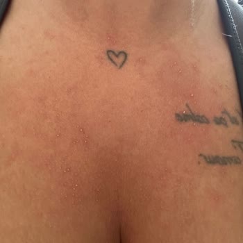 Ultra Kalıcı Denilen Parfüm Hem Kokusuz Hem Alerji Yaptı