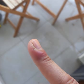 Yanlış Tedaviyle Kızımın Durumu Kötüleşti