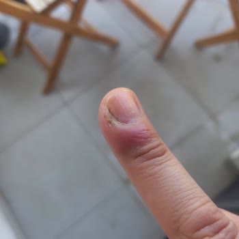 Yanlış Tedaviyle Kızımın Durumu Kötüleşti