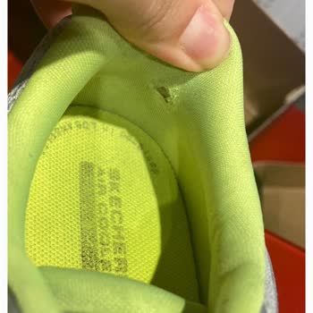 Skechers Ayakkabım Yırtıldı, Ne SuperStep Ne De Tüketici Hakları Dönüş Yapmıyor!