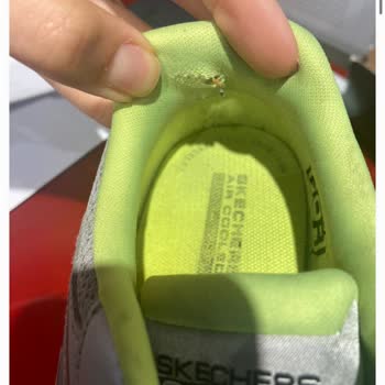 Skechers Ayakkabım Yırtıldı, Ne SuperStep Ne De Tüketici Hakları Dönüş Yapmıyor!