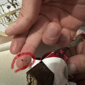 Torku Çikolata Gofretin İçinden Yabancı Cisim Çıktı, İlgilenilmiyor