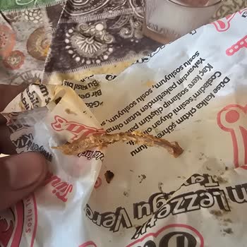 Dönerin İçinden Çıkan Kemik Diş Sağlığımı Tehlikeye Attı