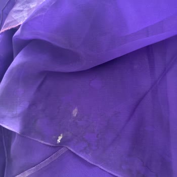 Yanlış Beden Ve Kusurlu Ürün İçin Destek Bekliyorum