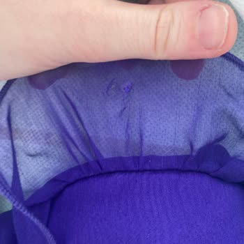 Yanlış Beden Ve Kusurlu Ürün İçin Destek Bekliyorum