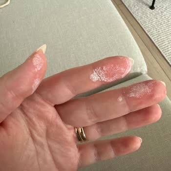 Leke Çıkarıcıyı Kullandıktan Sonra Ellerimde Ciddi Yanma Ve Acı Oluştu