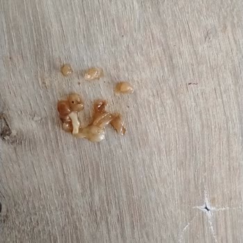 Hazır Noodle Paketinde Yabancı Madde Ve Hijyen Sorunu