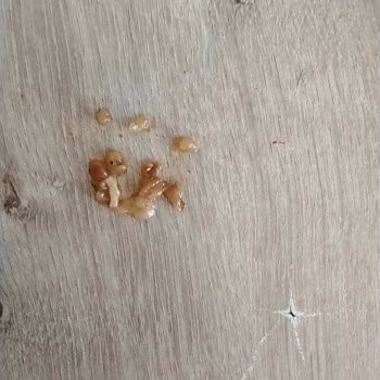 Hazır Noodle Paketinde Yabancı Madde Ve Hijyen Sorunu