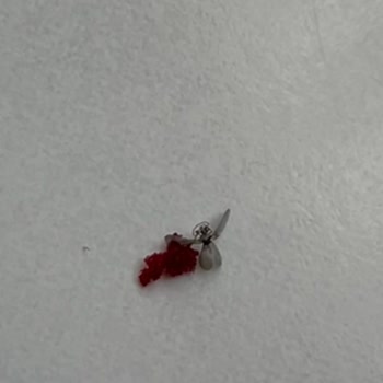 A101'den Aldığım Tatlıda Canlı Sinek Ve Böcek Çıktı, Hijyen Skandalı Yaşadım