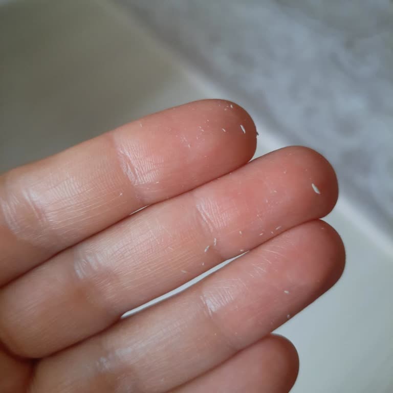 Bioderma Pigmentbio Güneş Kremi Cildimde Pütürlenme Ve Soyulma Yaptı