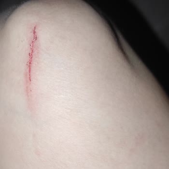 Yatsan Yastık Alezinde Yaşanan Güvenlik Sorunu Ve Yetersiz Müşteri Hizmeti