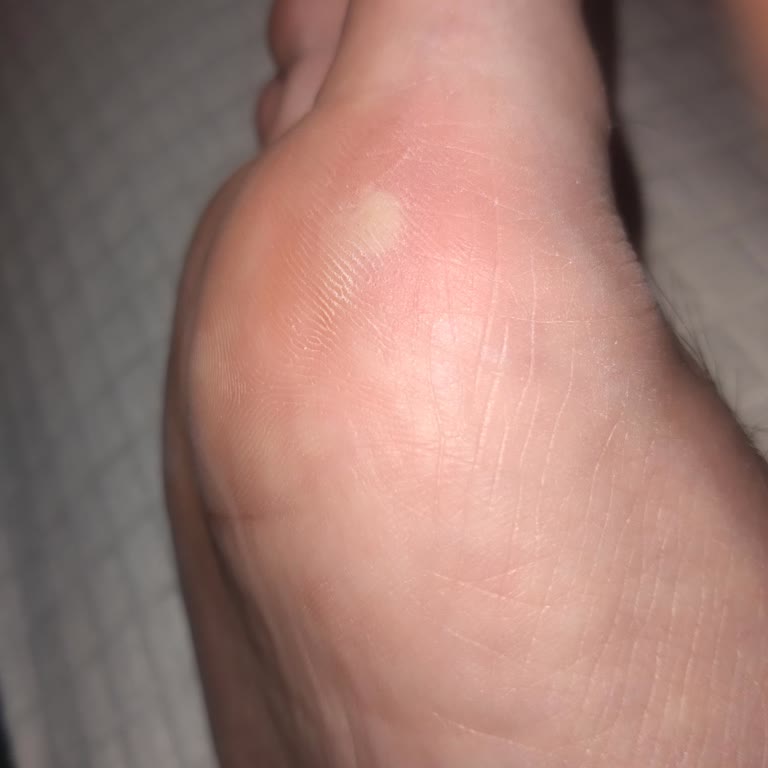 FLO Ayakkabı Akıllı Tabanlık Şikayeti!