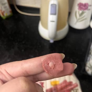 Dana Sosis Ürünü İçinden Yabancı Madde Çıkması Hakkında Şikayet