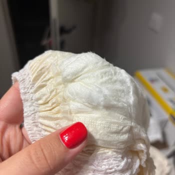 Sleepy Bebek Bezlerinde Ağır Koku Ve Yırtılma Sorunu Mağduriyet Yaşattı