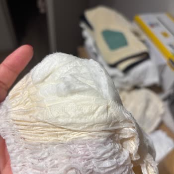 Sleepy Bebek Bezlerinde Ağır Koku Ve Yırtılma Sorunu Mağduriyet Yaşattı