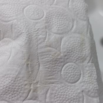 Familia Tuvalet Kağıdında Hijyen Sorunu Ve Sarı Leke Şikayeti
