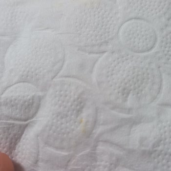 Familia Tuvalet Kağıdında Hijyen Sorunu Ve Sarı Leke Şikayeti