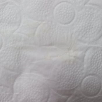 Familia Tuvalet Kağıdında Hijyen Sorunu Ve Sarı Leke Şikayeti