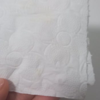 Familia Tuvalet Kağıdında Hijyen Sorunu Ve Sarı Leke Şikayeti