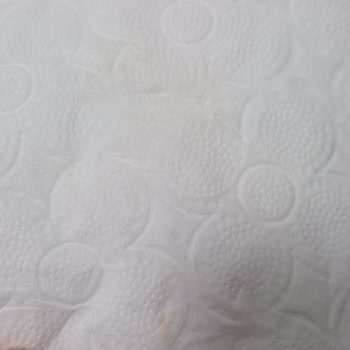 Familia Tuvalet Kağıdında Hijyen Sorunu Ve Sarı Leke Şikayeti