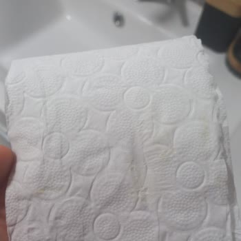 Familia Tuvalet Kağıdında Hijyen Sorunu Ve Sarı Leke Şikayeti