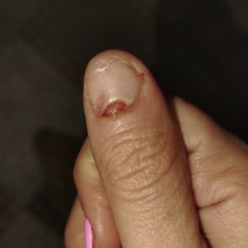 Serap Doğan Güzellik Merkezi'nden Şikayetçiyim