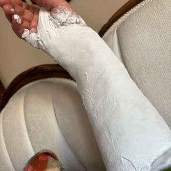 Kaygan Engelli Rampası Yüzünden Kolum Kırıldı!