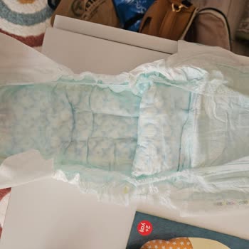 Prima 5 Numara Bebek Bezi Sızdırma Sorunu Ve Mağduriyet