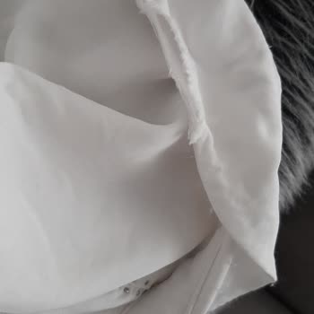 Kullanımda Yıpranan Ürün İçin Mağazadan Destek Alamıyorum