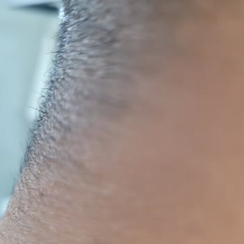 Seanslarda Sonuç Alamadım, Hijyen Ve İlgi Yetersiz