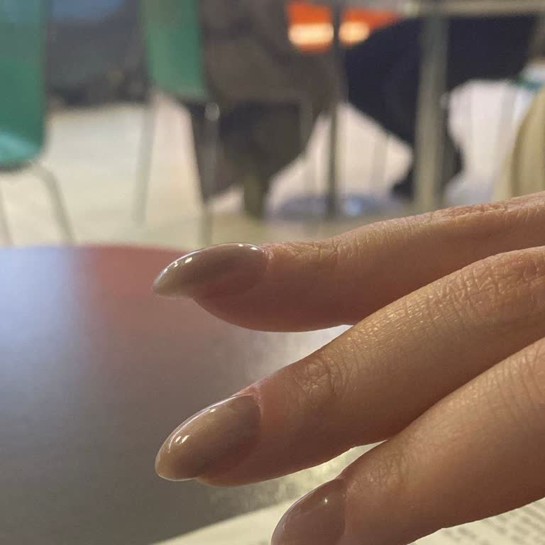 Olumsuz Tırnak Deneyimi Ve Kötü İletişim