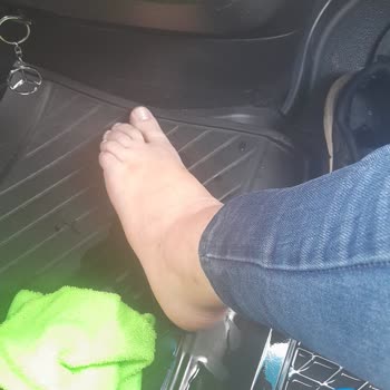 Seyahat Sırasında Şoförün Dikkatsizliği Sonucu Eşimin Ayağı Yandı, Firma Sorumluluğu Üstlenmiyor