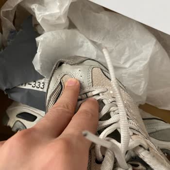 3 Ayda Açılan Dikişlere Garanti Reddi: Skechers Hayal Kırıklığı