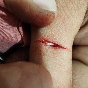 Acil Durumda Sağlık Sigortası Ameliyat Onayı Gecikti, Tedavi Reddedildi