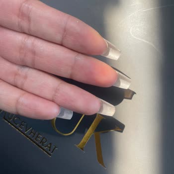 Peşin Ödeme Sonrası Ek Ücret Ve İlgisizlik Mağduriyetim