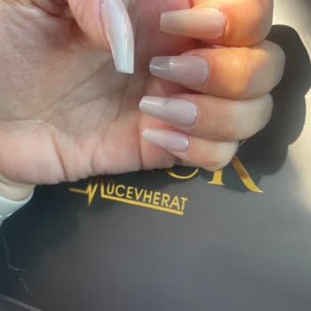 Peşin Ödeme Sonrası Ek Ücret Ve İlgisizlik Mağduriyetim