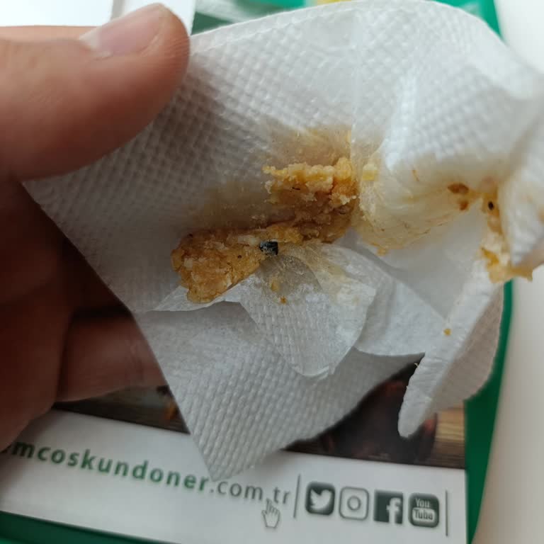 Dönerde Yabancı Madde Nedeniyle Dişim Kırıldı, Mağaza Sorumluluk Almadı