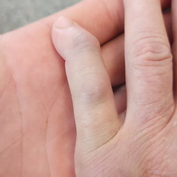 Acilde Tecrübesiz Doktor Nedeniyle Yanlış Teşhis Endişesi