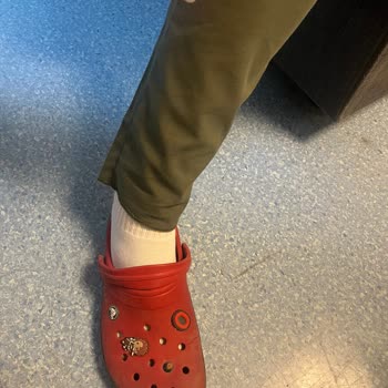 Crocs Terlikler Çoraplarımı Boyuyor, Mağduriyetim Giderilsin