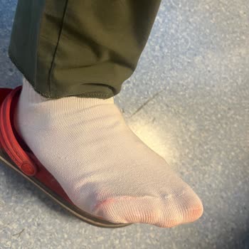 Crocs Terlikler Çoraplarımı Boyuyor, Mağduriyetim Giderilsin