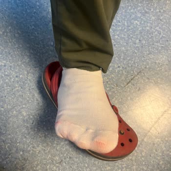 Crocs Terlikler Çoraplarımı Boyuyor, Mağduriyetim Giderilsin