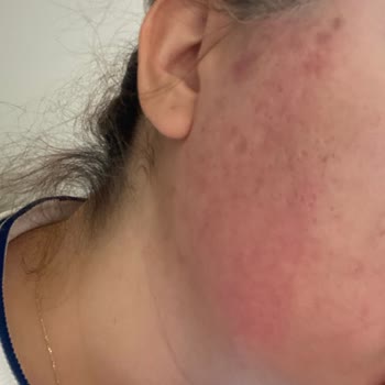 Yanlış Uygulama Ve İlgisiz Davranış Sonucu Mağduriyet