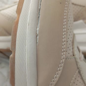 Skechers Ayakkabının Kısa Sürede Açılması Ve Kullanıcı Hatası Yanıtı