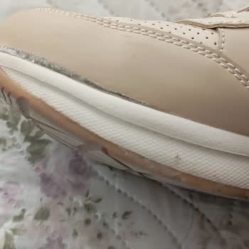 Skechers Ayakkabının Kısa Sürede Açılması Ve Kullanıcı Hatası Yanıtı