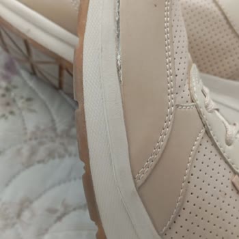 Skechers Ayakkabının Kısa Sürede Açılması Ve Kullanıcı Hatası Yanıtı