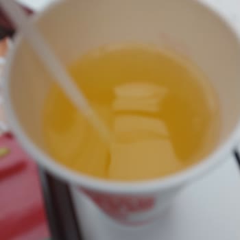 Siparişimde Hijyen Ve İçerik Sorunları: Saç Ve Yabancı Madde Şoku!