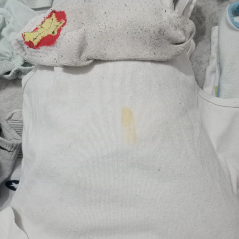 Vestel Çamaşır Makinesinde Leke Sorunu Ve Yetersiz Servis Yaklaşımı