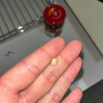Züber Granola Bar İçinden Taş Çıktı, Sağlığım Tehlikeye Girdi